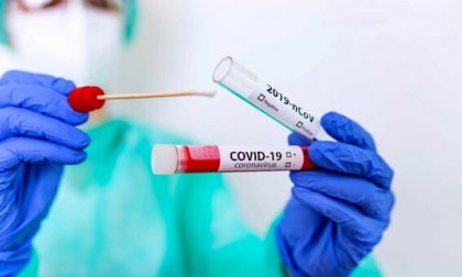 Coronavirus: un terzo di casi in meno da inizio settimana