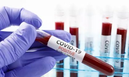 Coronavirus, 382 nuovi positivi. Calano decessi, ricoveri, terapie intensive